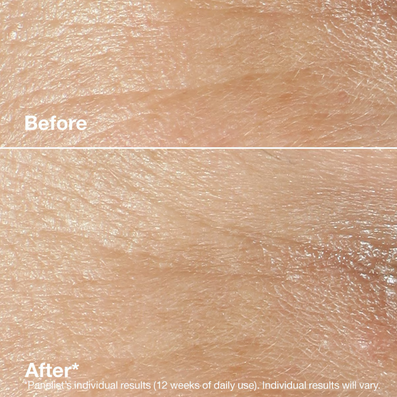 Clinique Smart Clinical Repair Wrinkle Correcting Rich Cream 50ml