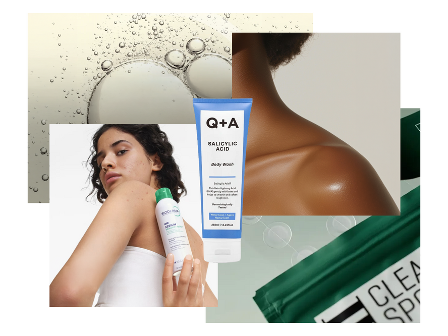 Person with clear skin on back and shoulders, illustrating Justmylook's guide to getting rid of body acne